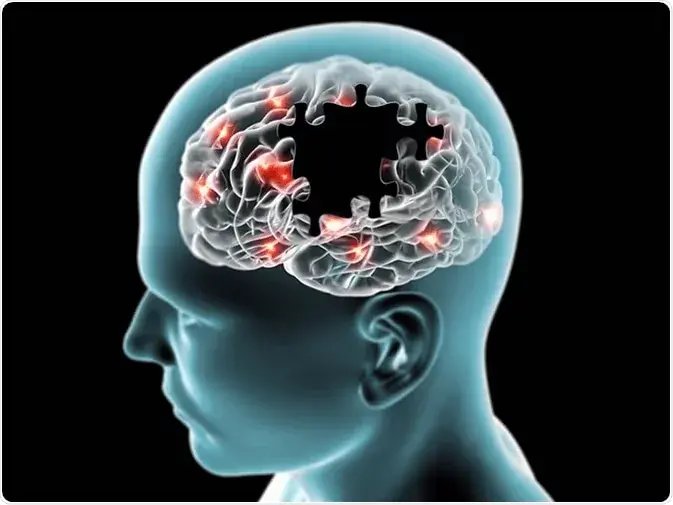 human brain